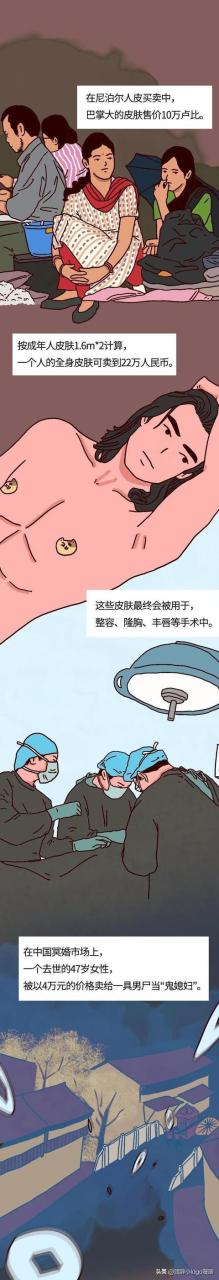 現在—個腎值多少錢插圖2